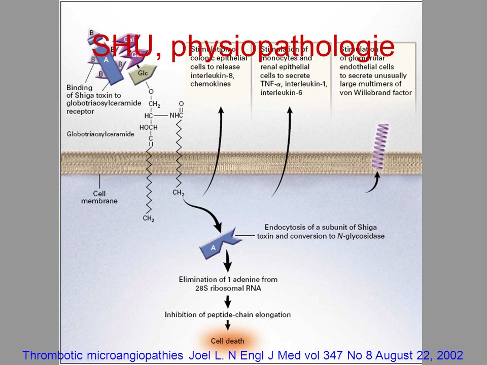 Prise En Charge Diagnostique Des Microangiopathies Thrombotiques Ppt